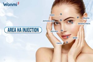 Area HA injection