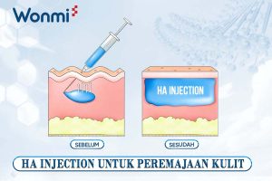 HA injection untuk peremajaan kulit