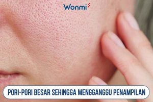 Dengan injeksi Meso, kulit terlihat lebih firm, glowing, dan awet muda.