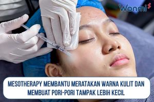 Mesotherapy membantu meratakan warna kulit dan menyamarkan pori-pori.