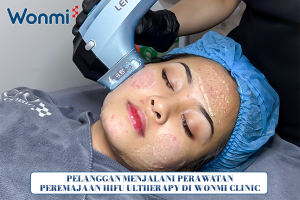 Pelanggan menjalani perawatan HiFu Ultherapy di Wonmi Clinic.