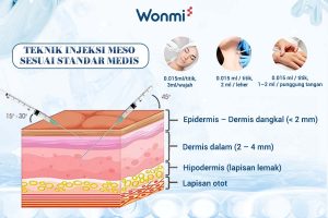 Teknik injeksi Meso dilakukan sesuai standar medis.